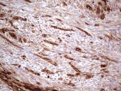 Immunohistochemistry: Galectin-9 Antibody (OTI1D12) [NBP2-45619]