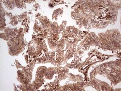 Immunohistochemistry: Galectin-9 Antibody (OTI1D12) [NBP2-45619]