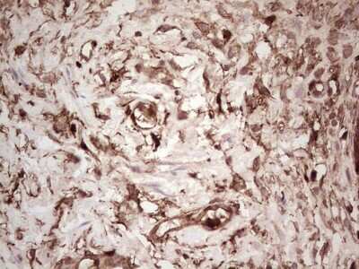 Immunohistochemistry: Galectin-9 Antibody (OTI1D12) [NBP2-45619]