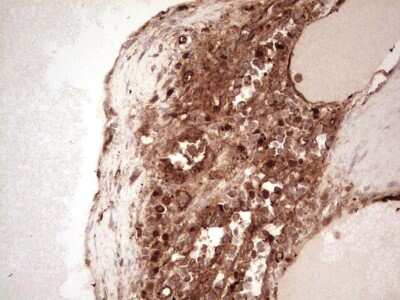 Immunohistochemistry: Galectin-9 Antibody (OTI1D12) [NBP2-45619]