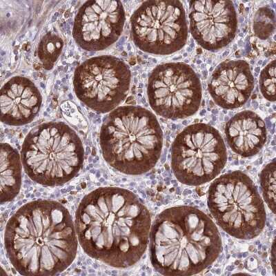 Immunohistochemistry-Paraffin: Galectin-9 Antibody [NBP2-33484]