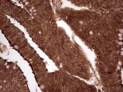 Immunohistochemistry: Galectin-9 Antibody (OTI1D12) - Azide and BSA Free [NBP2-71132]
