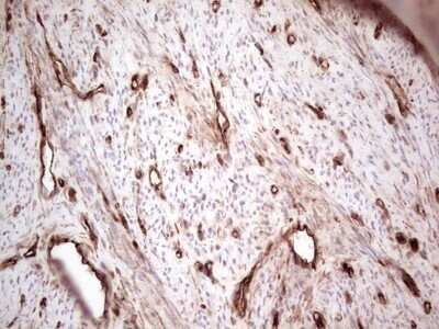 Immunohistochemistry: Galectin-9 Antibody (OTI1D12) - Azide and BSA Free [NBP2-71132]