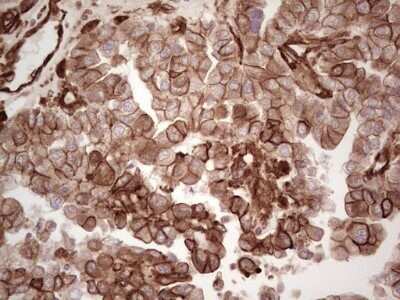 Immunohistochemistry: Galectin-9 Antibody (OTI1D12) - Azide and BSA Free [NBP2-71132]