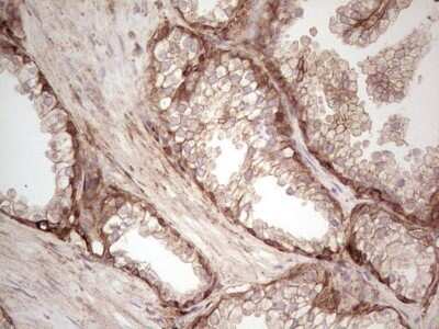 Immunohistochemistry: Galectin-9 Antibody (OTI1D12) - Azide and BSA Free [NBP2-71132]