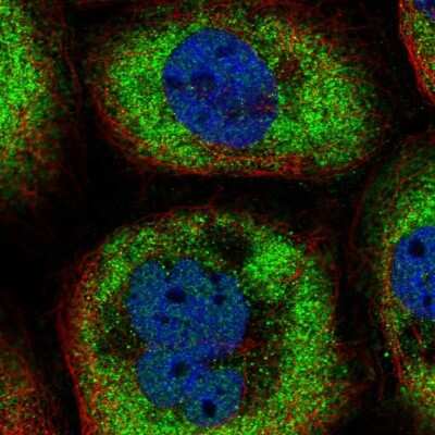 Immunocytochemistry/ Immunofluorescence: Galectin-9B Antibody [NBP2-33473]