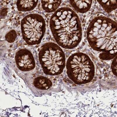 Immunohistochemistry-Paraffin: Galectin-9B Antibody [NBP2-33473]