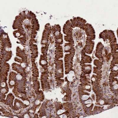 Immunohistochemistry-Paraffin: Galectin-9B Antibody [NBP2-33473]