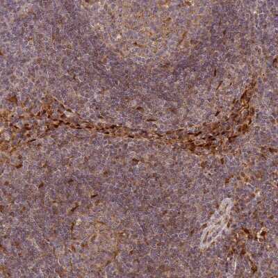 Immunohistochemistry-Paraffin: Galectin-9B Antibody [NBP2-33473]
