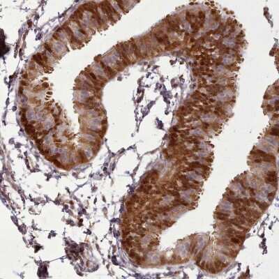 Immunohistochemistry-Paraffin: Galectin-9B Antibody [NBP2-33473]