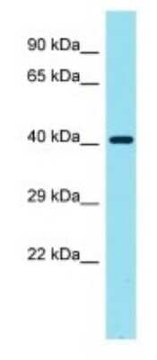 Western Blot: Galectin-9C Antibody [NBP3-09747]