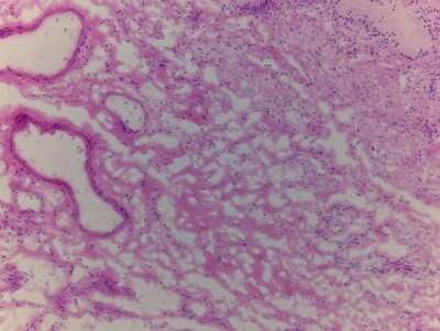 Hematoxylin & Eosin Stain: Gallbladder Tissue Slides (Adult Normal)- Frozen [NBP2-77569]