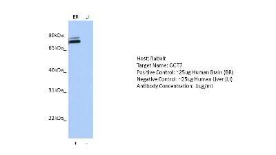 Western Blot: Gamma-Glutamyltransferase 7 Antibody [NBP2-84952]