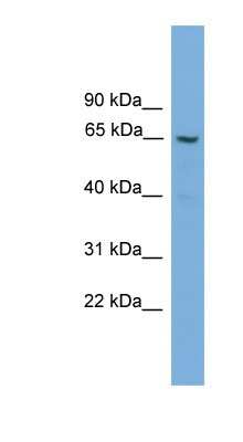 Western Blot: Gamma-glutamyltransferase 2 Antibody [NBP1-79312]