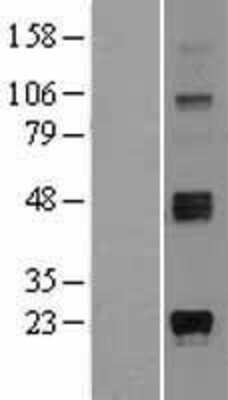 Western Blot: ST8 alpha-2,8-Sialyltransferase 8A/ST8SIA1/Ganglioside GD3 Overexpression Lysate [NBL1-16505]