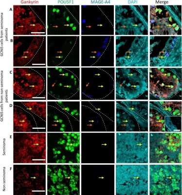 Immunocytochemistry/ Immunofluorescence: Gankyrin Antibody [NBP1-82443]