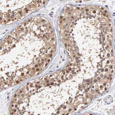 Immunohistochemistry-Paraffin: Gankyrin Antibody [NBP1-82443]