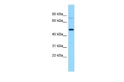 Western Blot: Gasdermin-A Antibody [NBP2-84954]