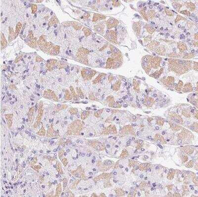 Immunohistochemistry-Paraffin: Gasdermin-C Antibody [NBP1-91926]