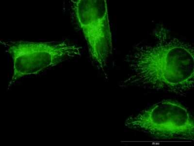Immunocytochemistry/ Immunofluorescence: Gasdermin like Antibody (1E10) [H00055876-M05]