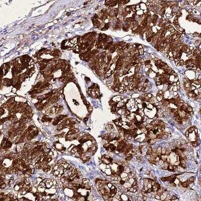 Immunohistochemistry-Paraffin: Gastric Lipase Antibody [NBP1-91928]