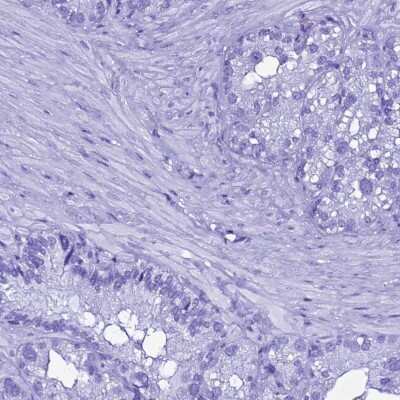 Immunohistochemistry-Paraffin: Gastric Lipase Antibody [NBP1-91928]