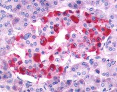 Immunohistochemistry-Paraffin: Gastrin-releasing Peptide R/GRPR Antibody - BSA Free [NLS830]