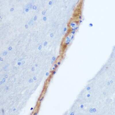 Immunohistochemistry-Paraffin: Gastrin-releasing Peptide/Bombesin/Neuromedin C Antibody - BSA Free [NBP3-03282]
