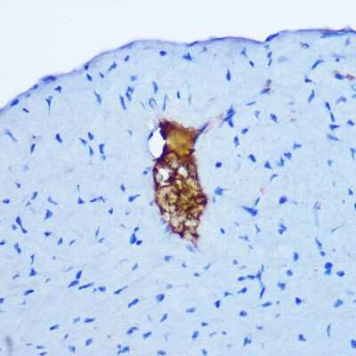Immunohistochemistry-Paraffin: Gastrin-releasing Peptide/Bombesin/Neuromedin C Antibody - BSA Free [NBP3-03282]