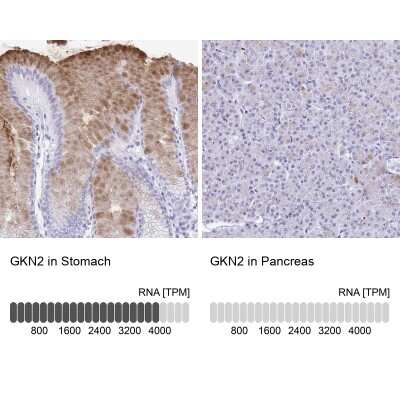 Immunohistochemistry-Paraffin: Gastrokine 2 Antibody [NBP2-31688]