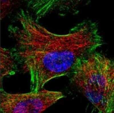 Immunocytochemistry/ Immunofluorescence: Gelsolin/GSN Antibody (20) - BSA Free [NBP1-05161]
