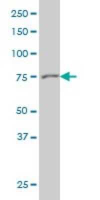 Western Blot: Gelsolin/GSN Antibody (3G5) [H00002934-M01]