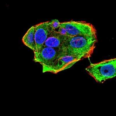 Immunocytochemistry/ Immunofluorescence: Gemin 3 Antibody (1C9F6) - BSA Free [NBP2-52454]