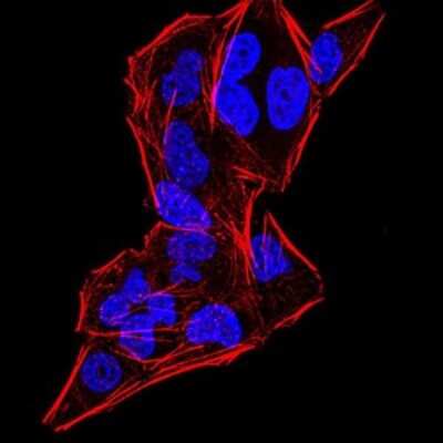 Immunocytochemistry/ Immunofluorescence: Gemin 3 Antibody (7B2B1) - BSA Free [NBP2-52453]