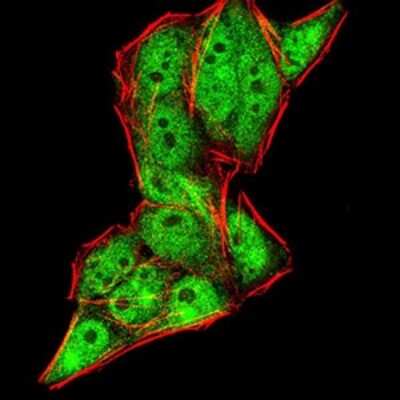 Immunocytochemistry/ Immunofluorescence: Gemin 3 Antibody (7B2B1) - BSA Free [NBP2-52453]