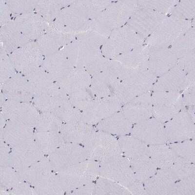 Immunohistochemistry-Paraffin: Gemin 3 Antibody [NBP1-84058]
