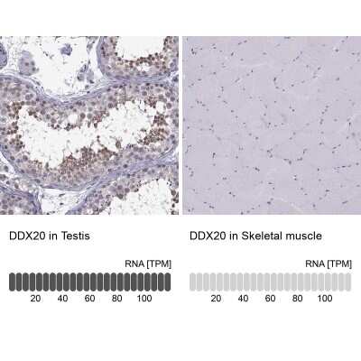 Immunohistochemistry-Paraffin: Gemin 3 Antibody [NBP1-84058]
