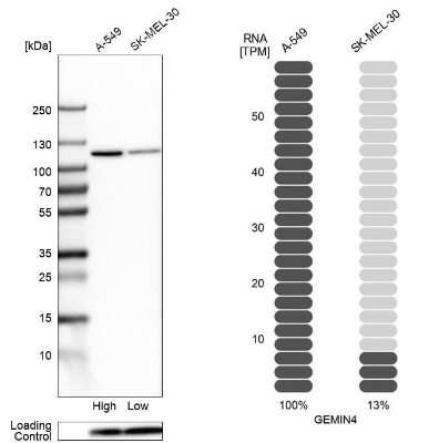 Western Blot: Gemin 4 Antibody [NBP2-55998]