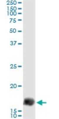 Immunoprecipitation: Gemin 7 Antibody (4H6) [H00079760-M09]