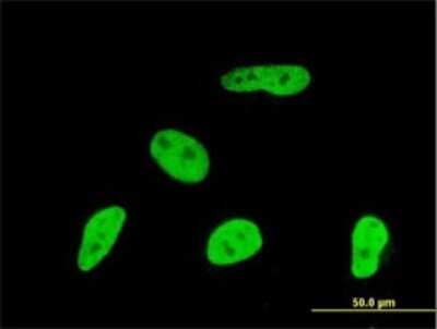Immunocytochemistry/ Immunofluorescence: Geminin Antibody (1A8) [H00051053-M01]