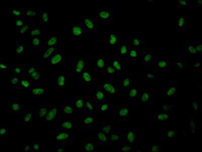 Immunocytochemistry/ Immunofluorescence: Geminin Antibody (8H8) [NBP3-15158]