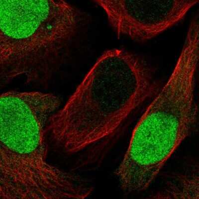Immunocytochemistry/ Immunofluorescence: Geminin Antibody [NBP2-56766]