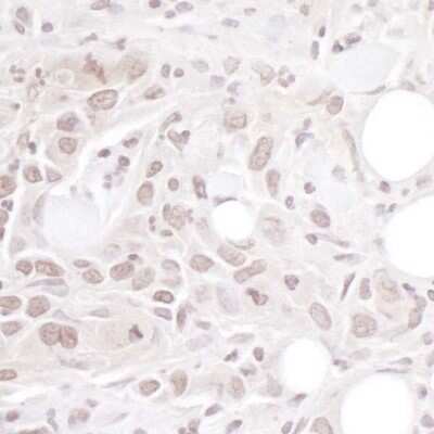 Immunohistochemistry: Geminin Antibody [NB100-40826]