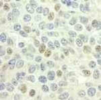 Immunohistochemistry-Paraffin: Geminin Antibody [NB100-40826]