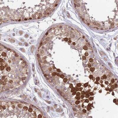 Immunohistochemistry-Paraffin: Geminin Antibody [NBP2-14058]