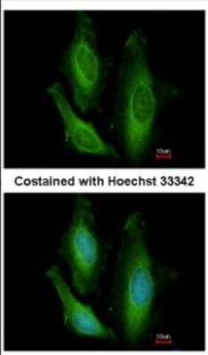 Immunocytochemistry/ Immunofluorescence: Genethonin 1 Antibody [NBP2-16640]