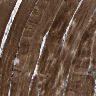 Immunohistochemistry-Paraffin: Genethonin 1 Antibody [NBP1-91935]