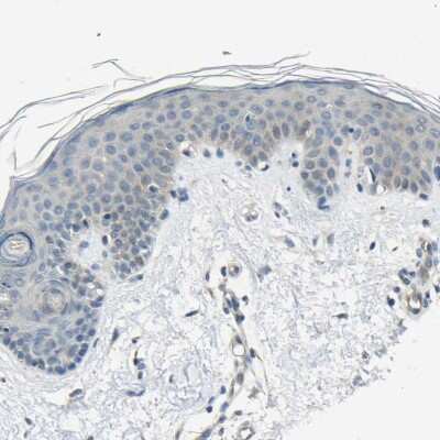 Immunohistochemistry-Paraffin: Genethonin 1 Antibody [NBP1-91935]