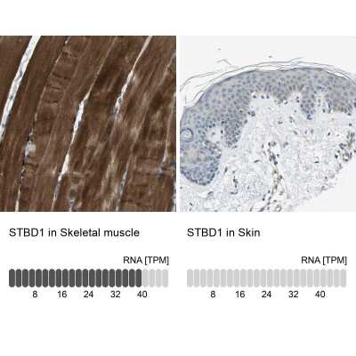 Immunohistochemistry-Paraffin: Genethonin 1 Antibody [NBP1-91935]