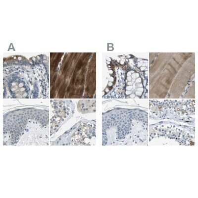 Immunohistochemistry-Paraffin: Genethonin 1 Antibody [NBP1-91935]